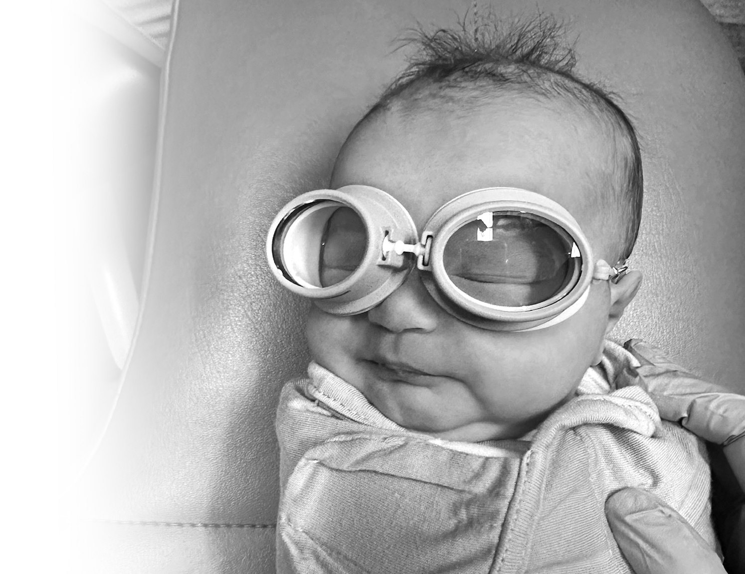 laser tongue tie – goggles